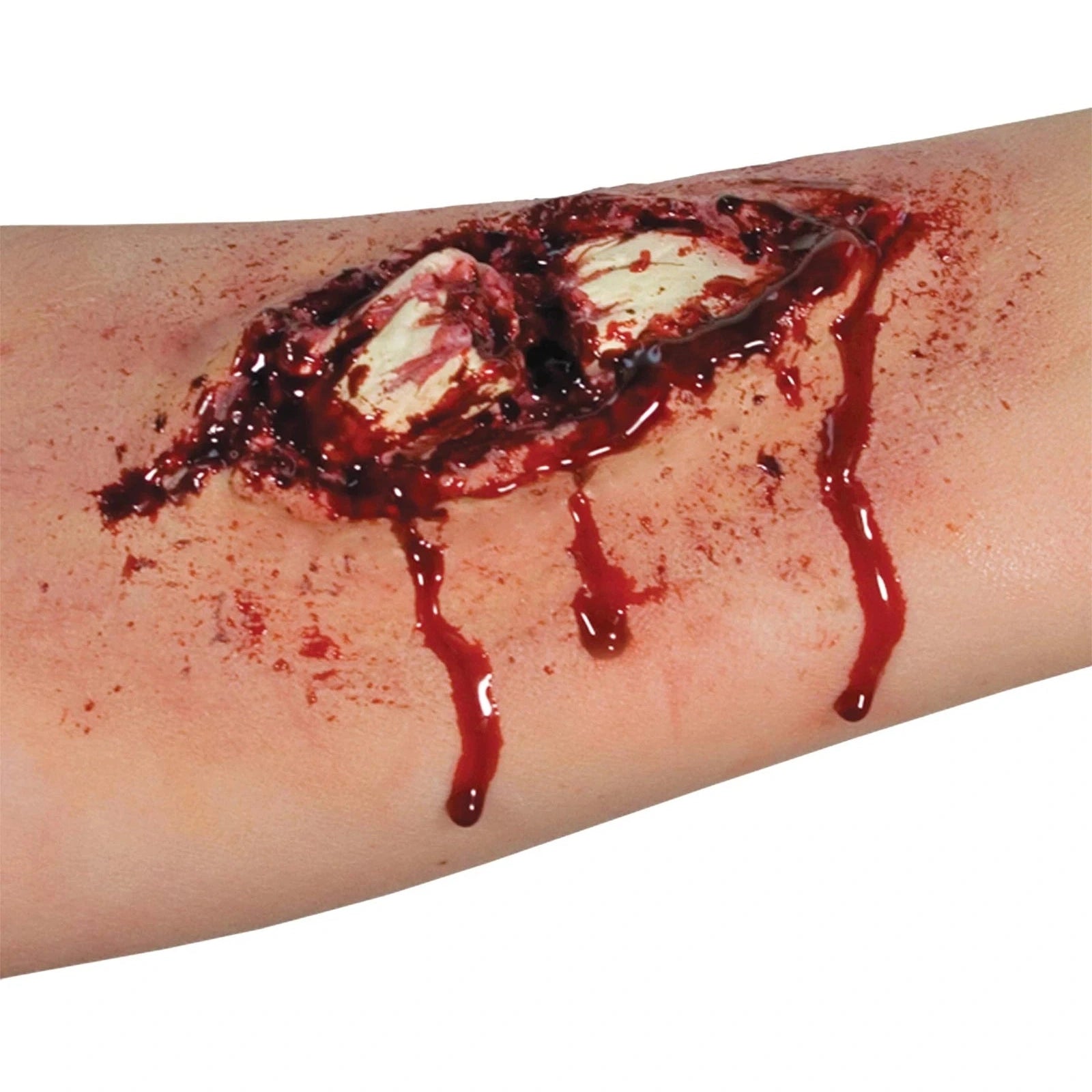EZ FX Broken Bone Kit